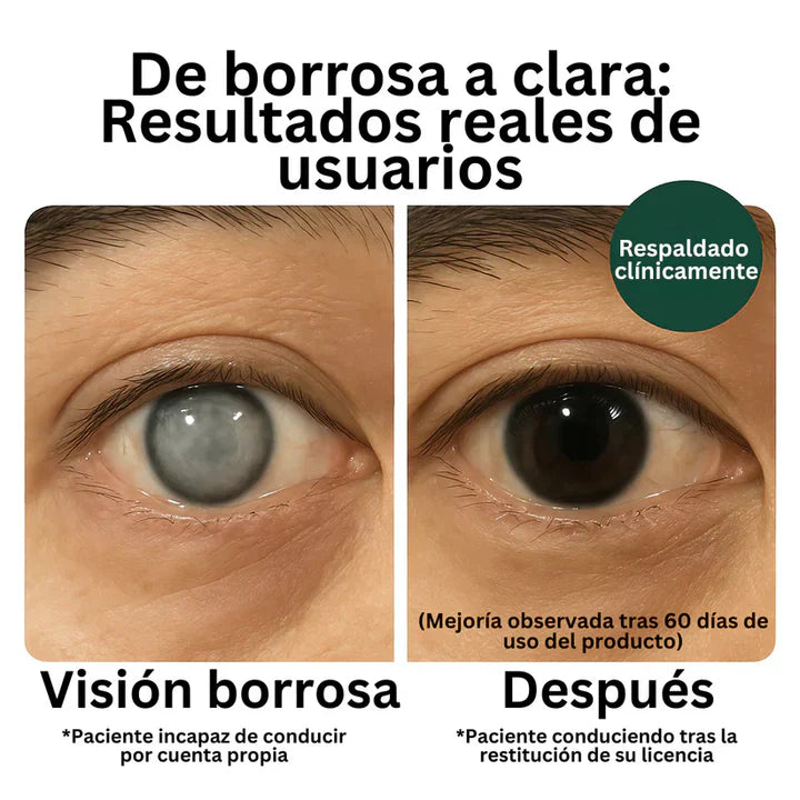 Zoone™ Suplemento de Luteína para los ojos